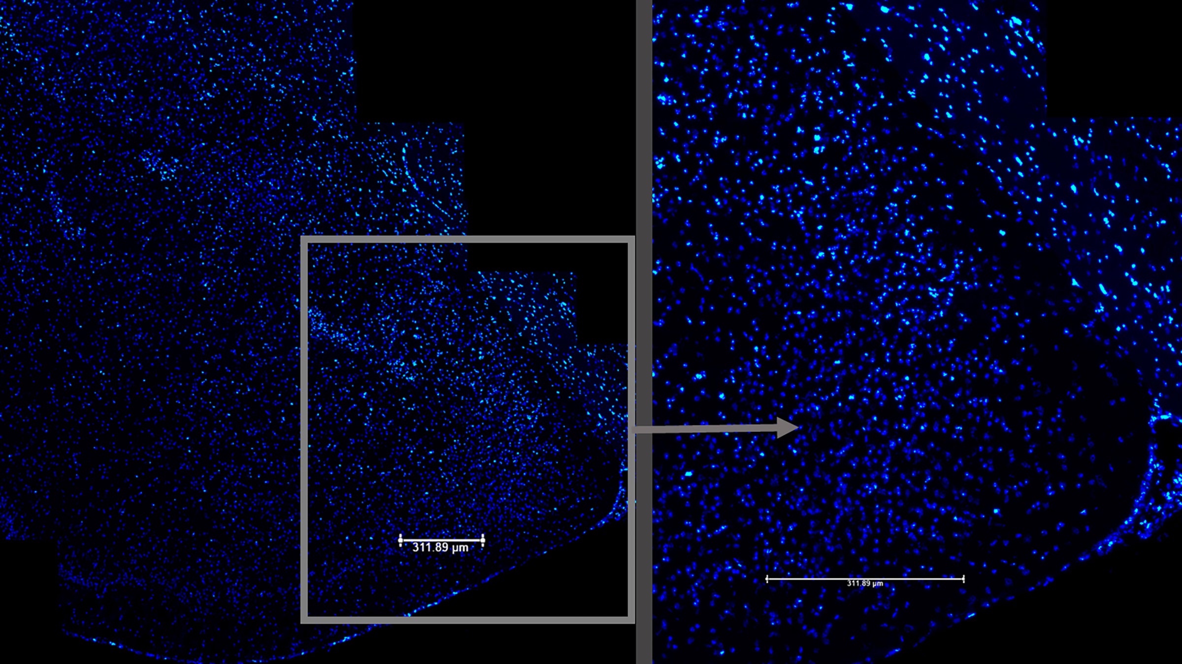 Blue speckles on a black background represent imaging of the mouse amygdala