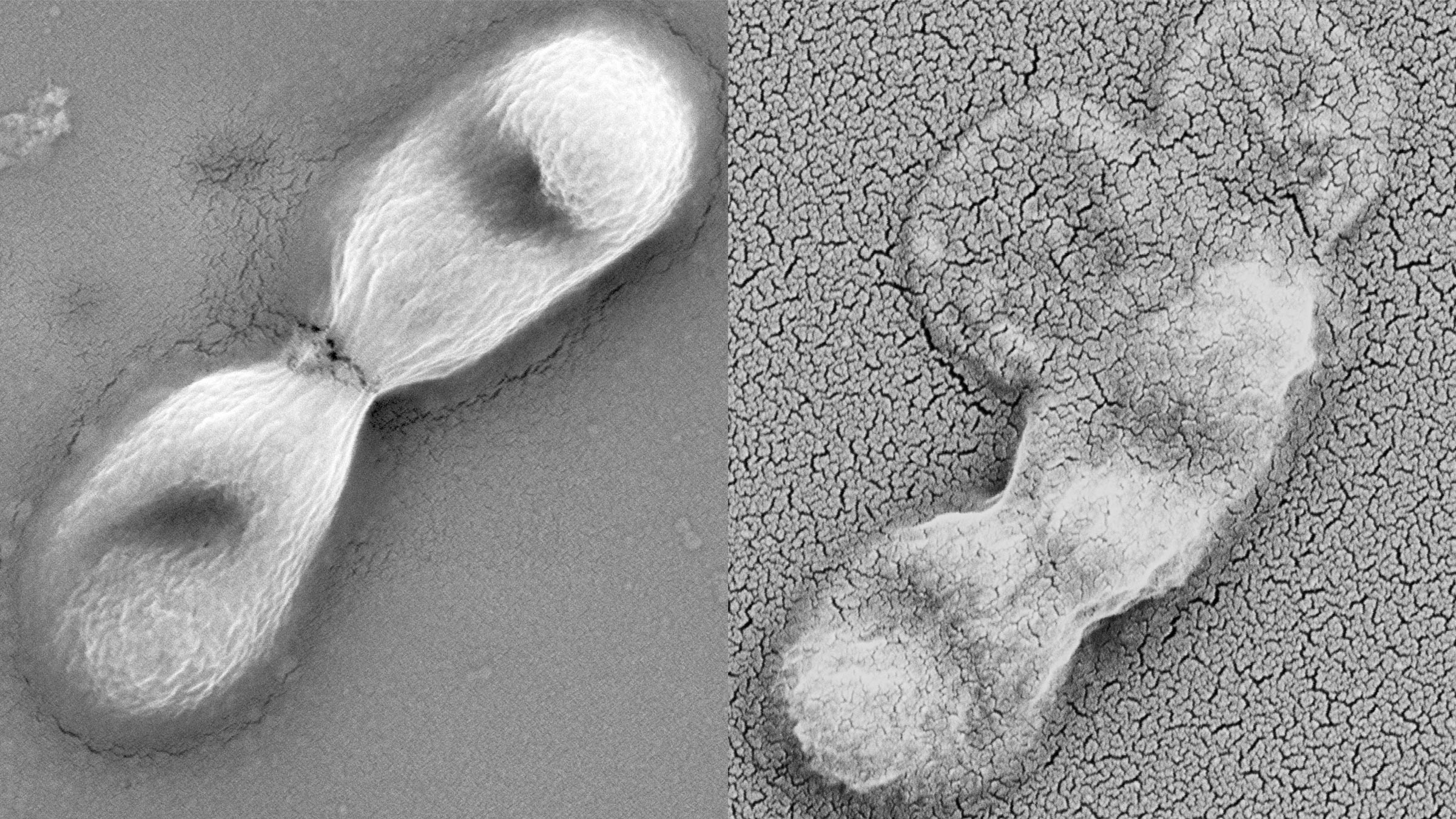 Two black and white microscope images. On the left is an intact bacterium with two lobes like a bar bell. On the right is a similar bacterium whose walls have burst, spilling its contents.