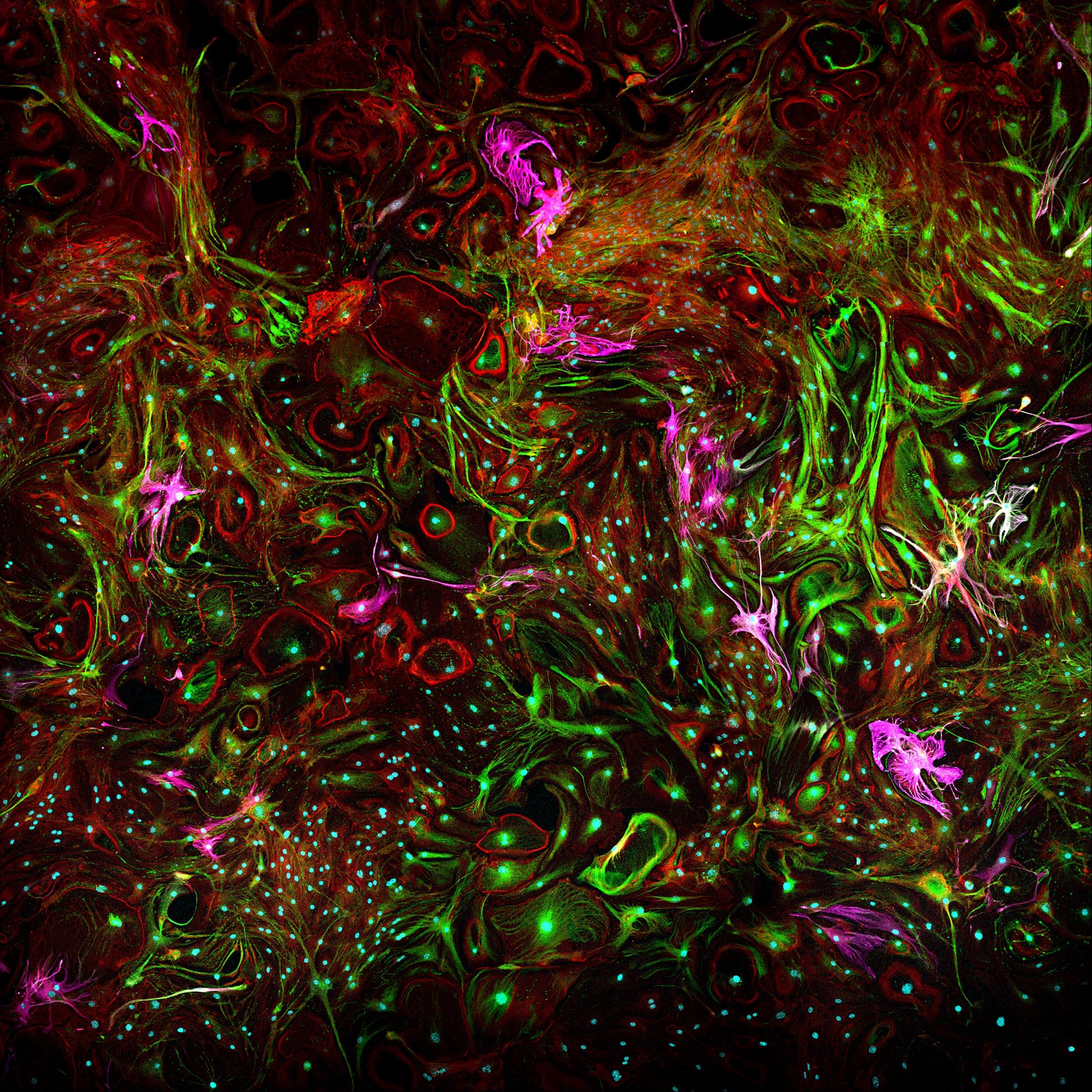 Swirls of green, pink and fuschia show up in this culture of astrocytes that were stained using immunohistochemistry.