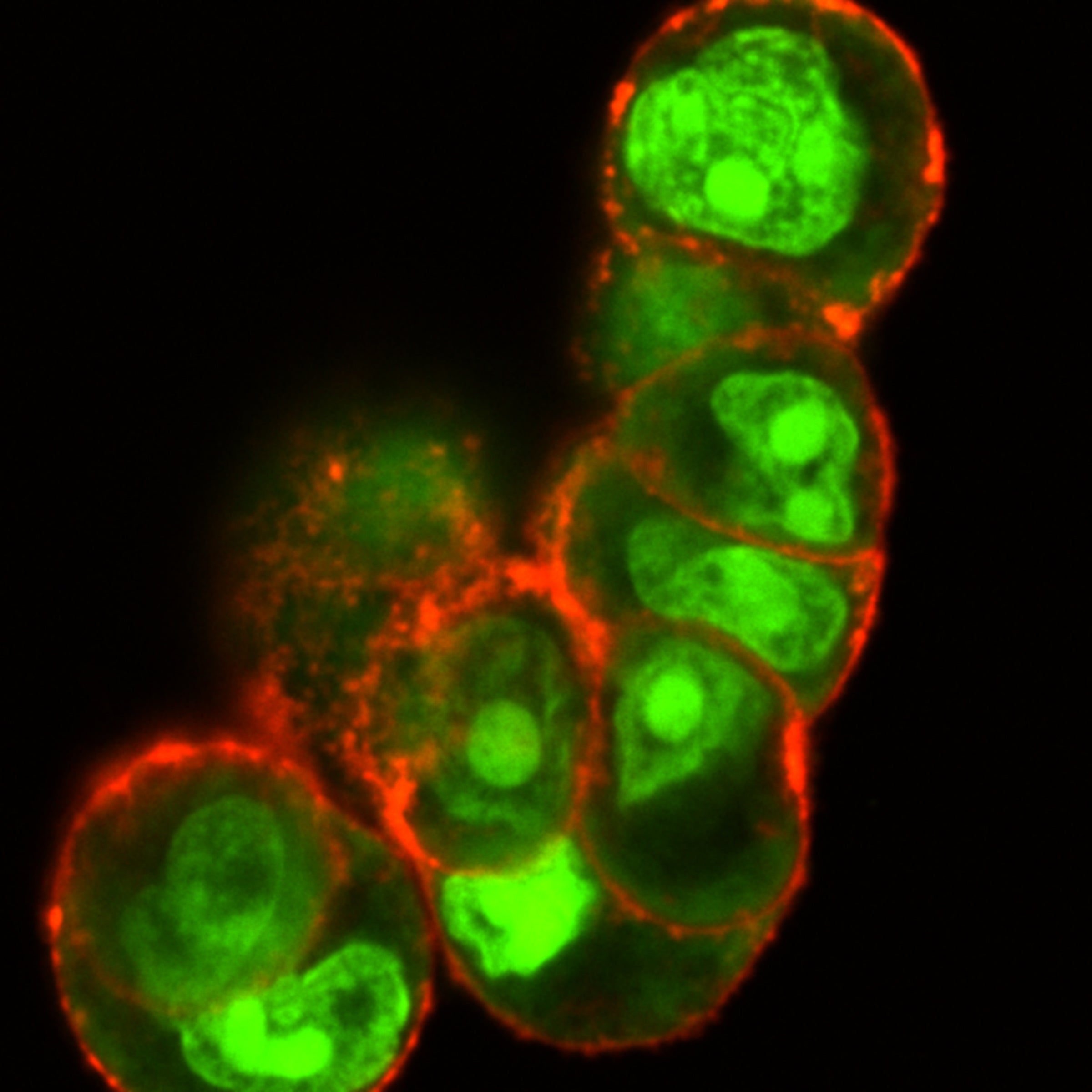 Eight large round cells outlined in red contain smalled green blobs within. The large cells are attached in a string. The cell wall of one of the cells on the bottom left has broken apart into granules, releasing a green globule into the blackness surrounding the cells.