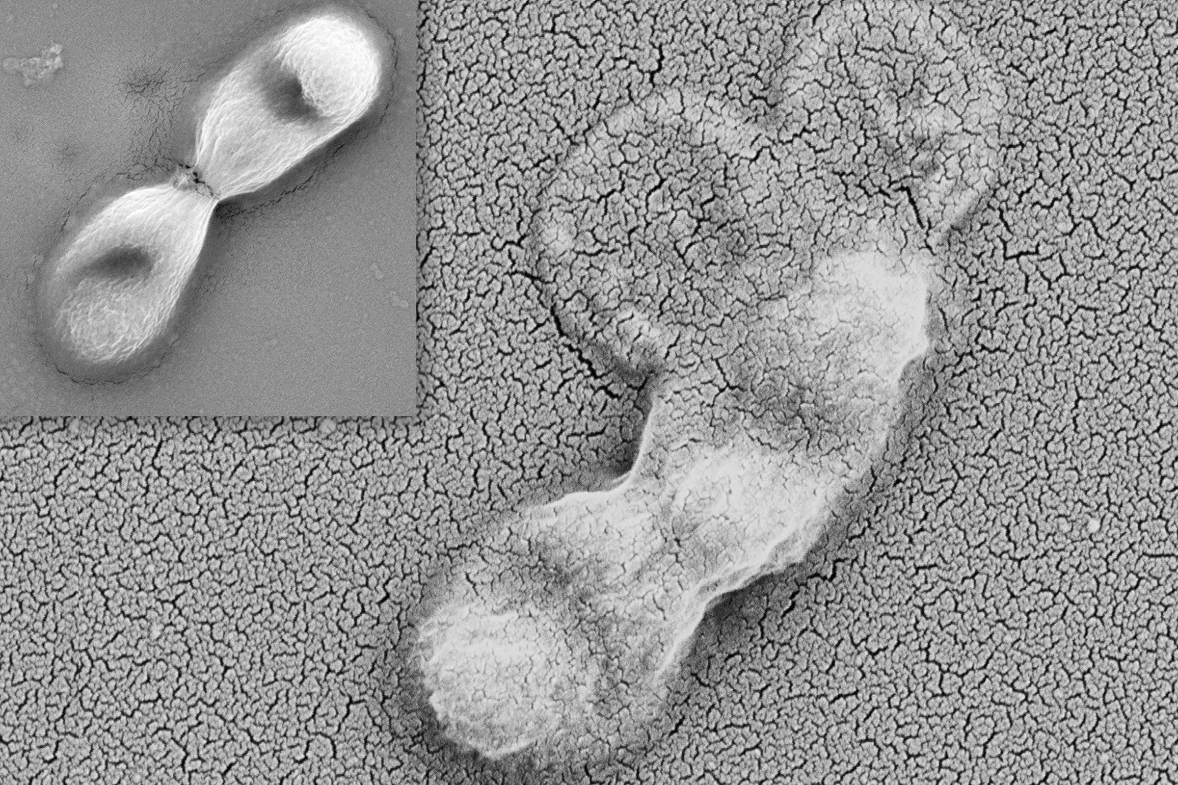 Two black and white microscope images. On the left is an intact bacterium with two lobes like a bar bell. On the right is a similar bacterium whose walls have burst, spilling its contents.