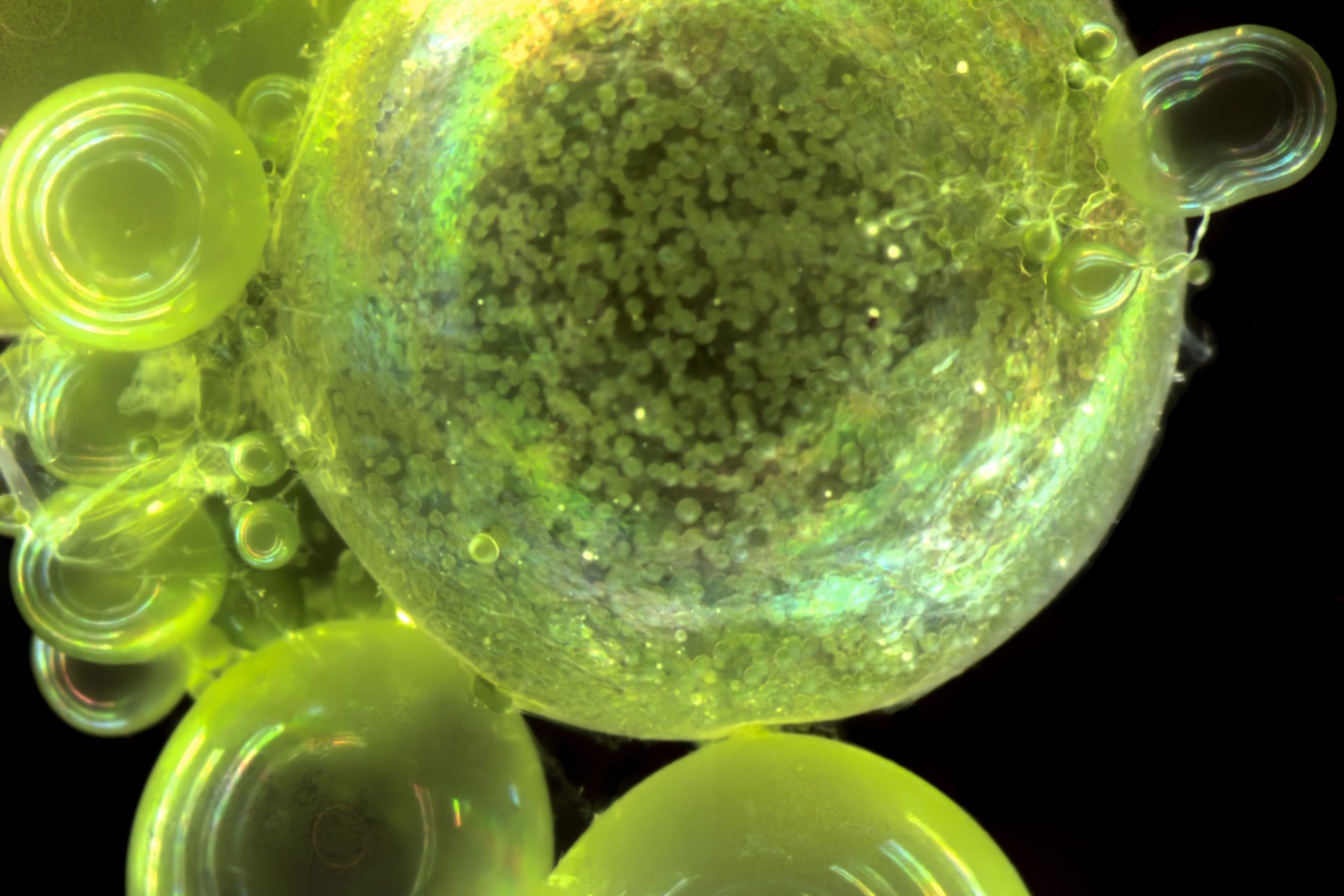 Green spherical semi-transparent cells on a black background