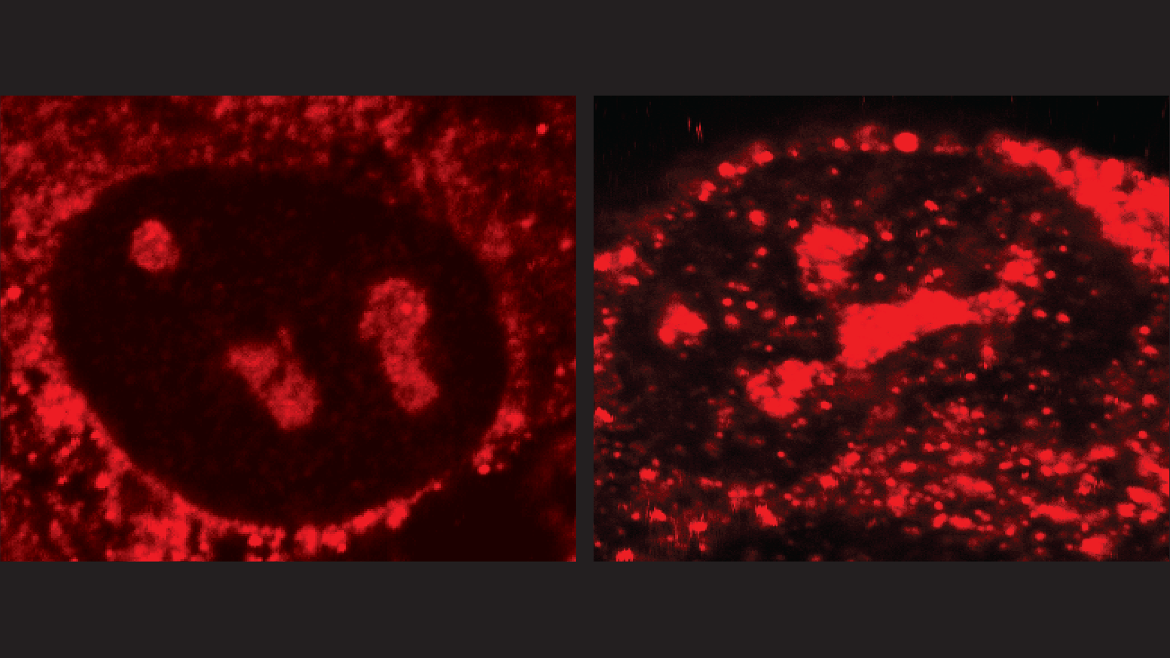 Red dots under a microscope indicate the location and quantity of R-loops in cancer cells