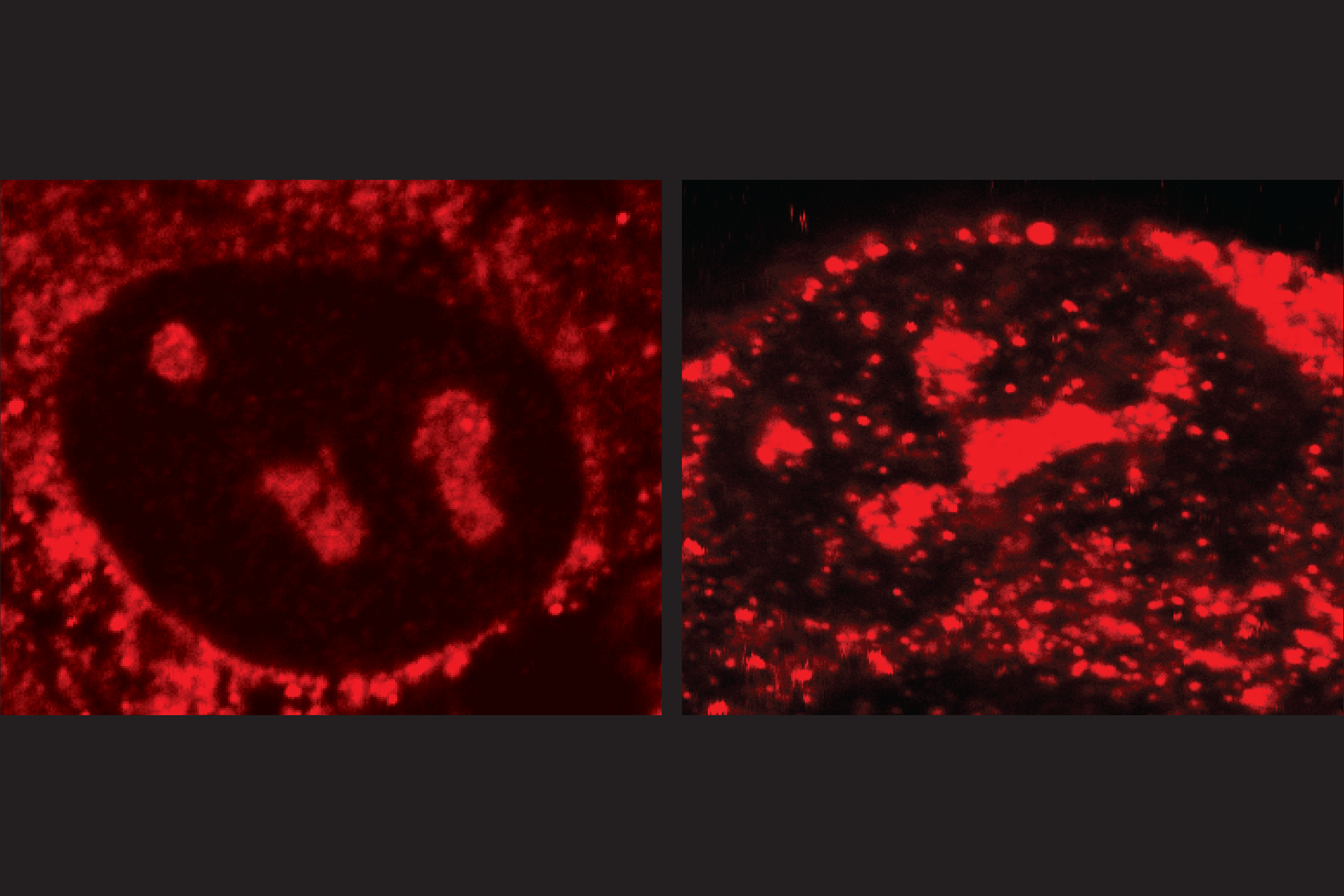 Red dots under a microscope indicate the location and quantity of R-loops in cancer cells