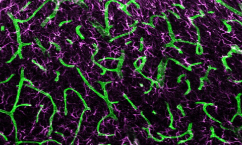 Blood vessels, shown in green, and astrocytes, shown in magenta, adjacent to a stroke.