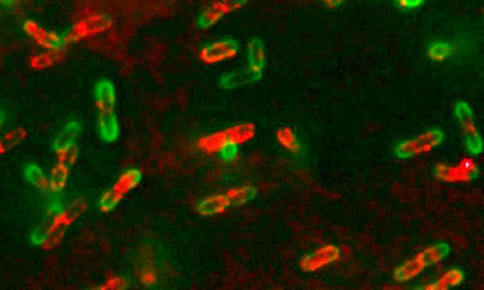 Bacterial cells in microscopic image. Some are stained green and others bright orange on a black background.