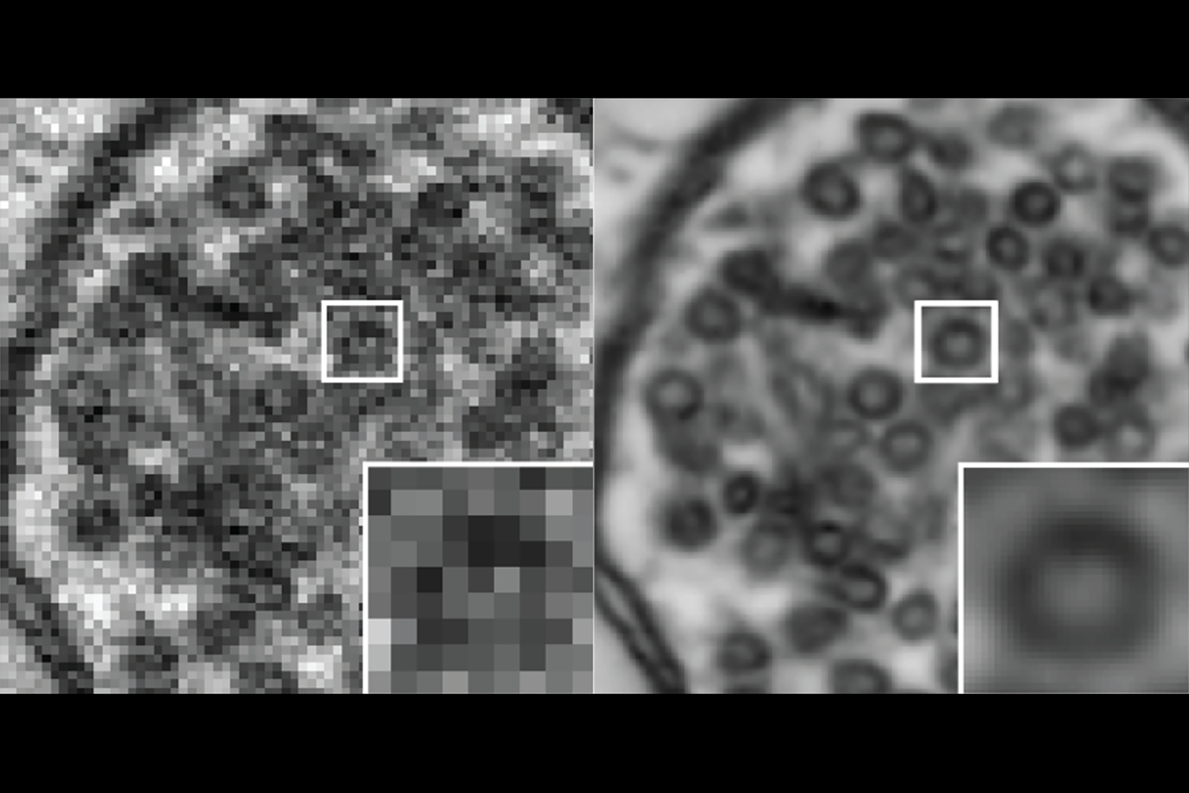 Comparison of brain imaging before and after the new technique