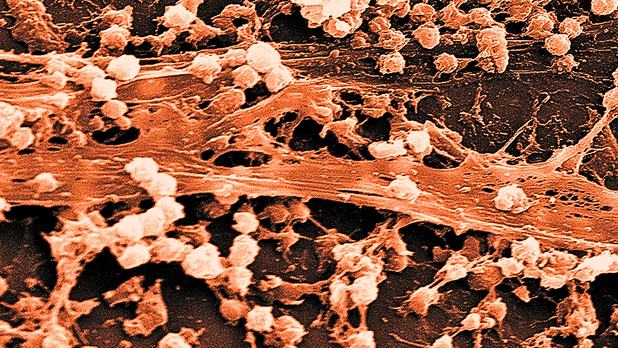 Electron microscope image of bacterial biofilm