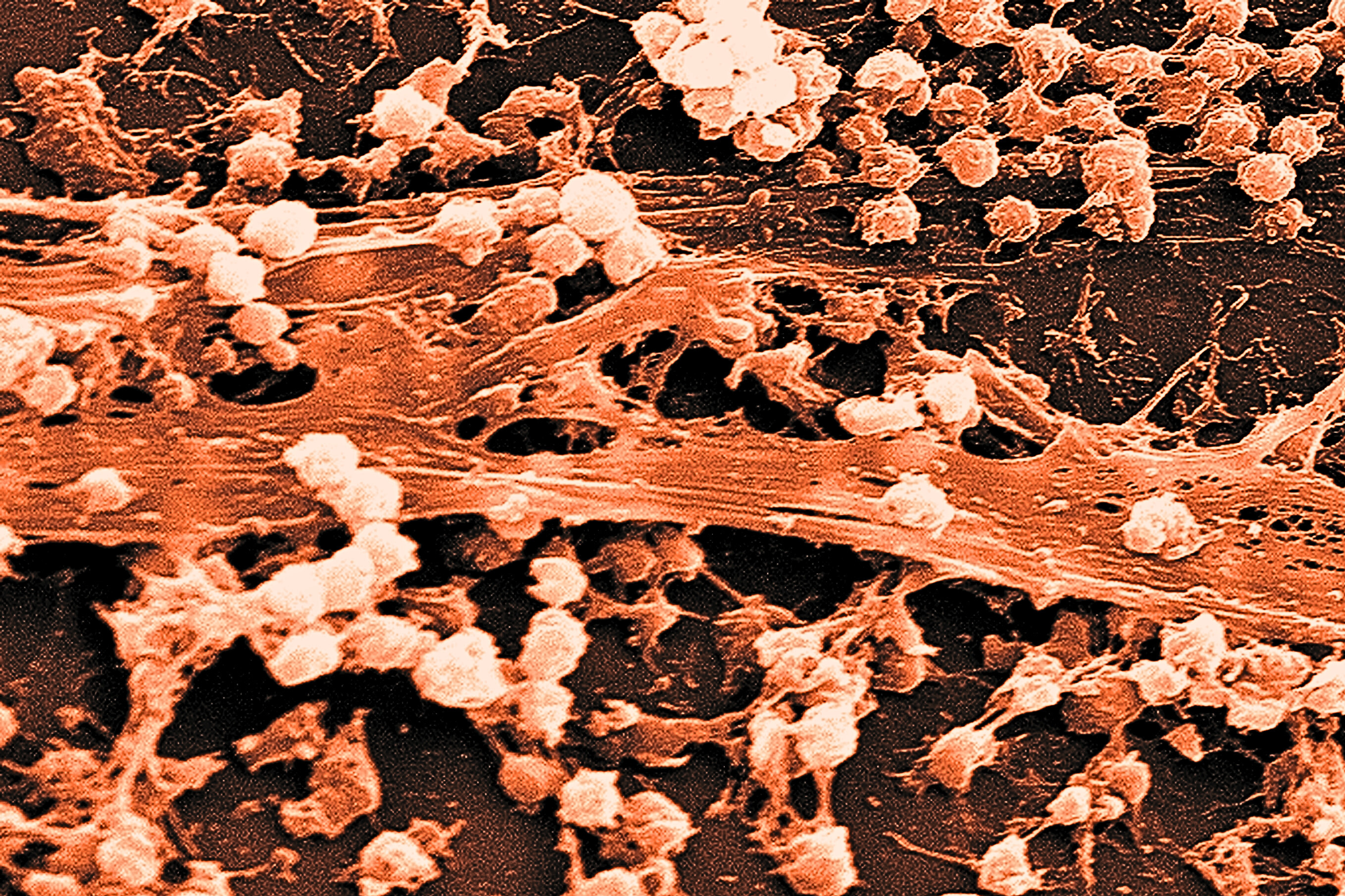 Electron microscope image of bacterial biofilm