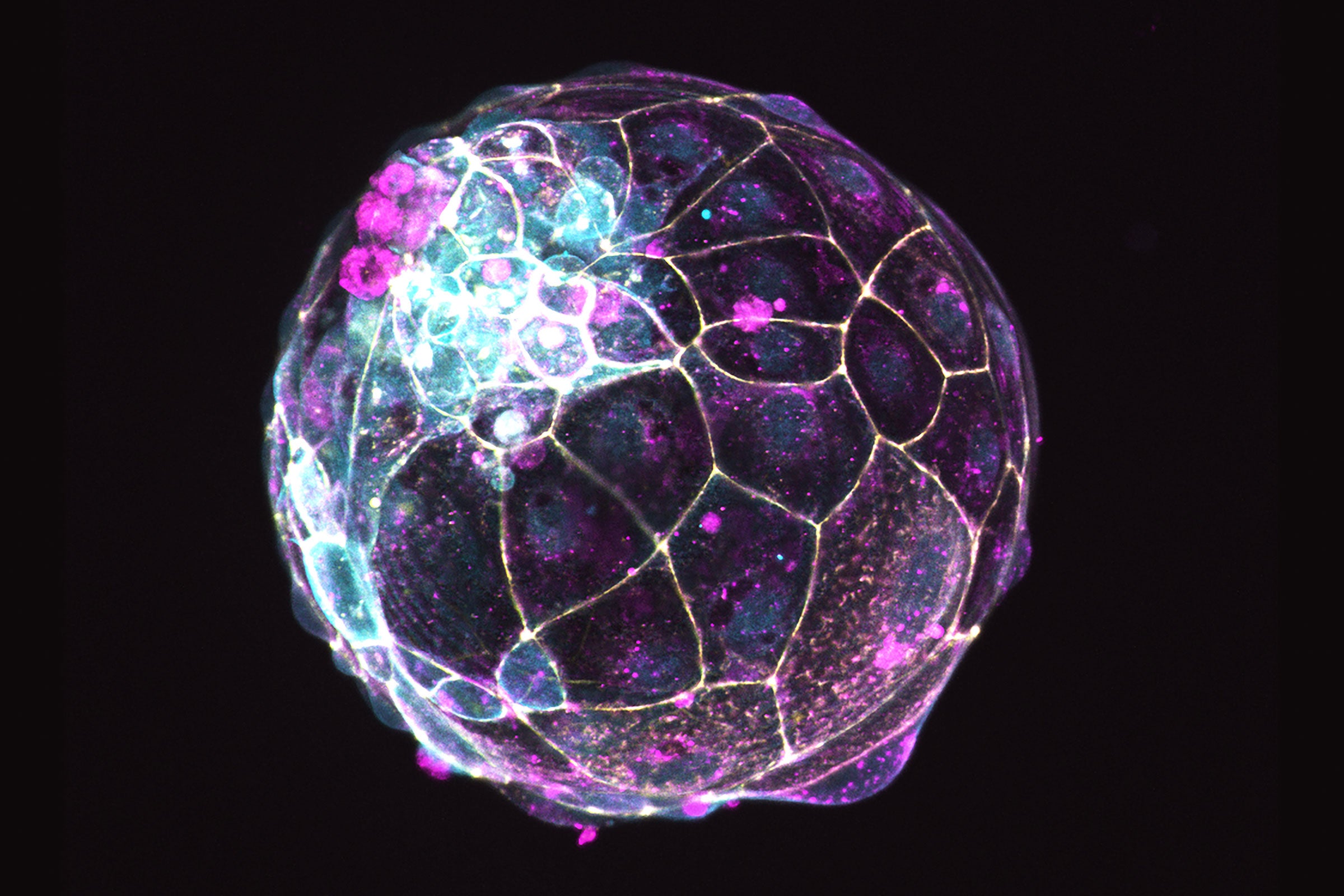 Microscope image of a blastoid, a model of an early embryo