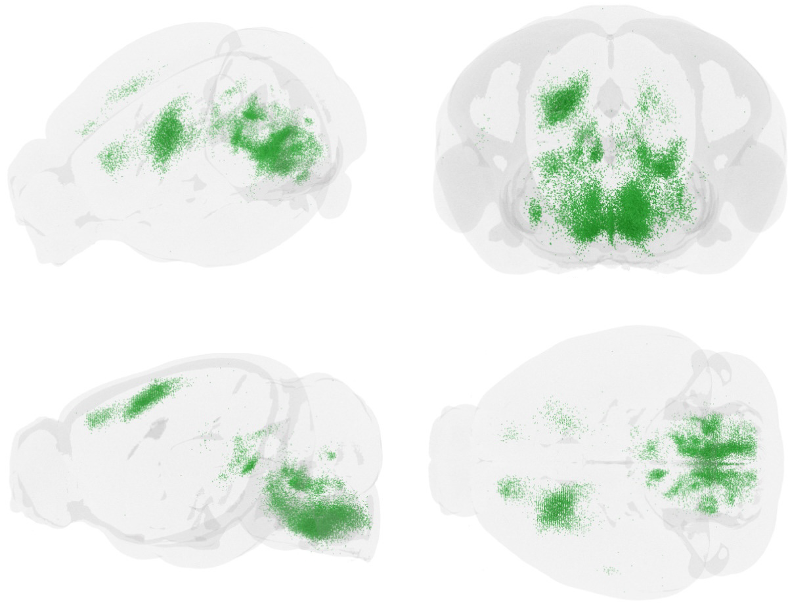 Four graphics represent differfent angles on a brain, with areas lit up where specific neurons are connected or active.
