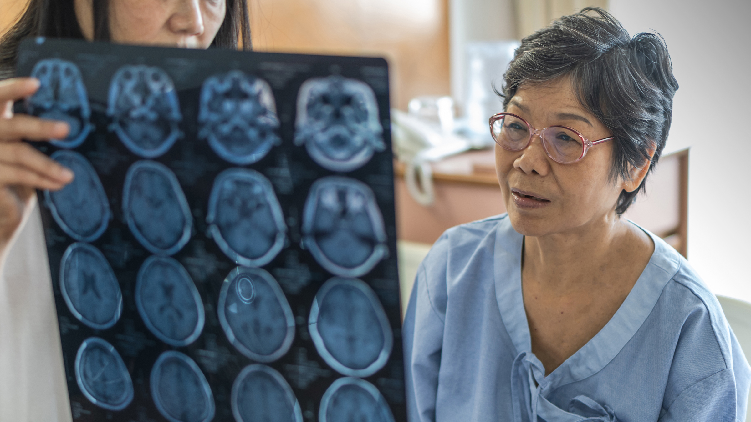 A doctor shows a brain scan image to a woman in a blue hospital gown