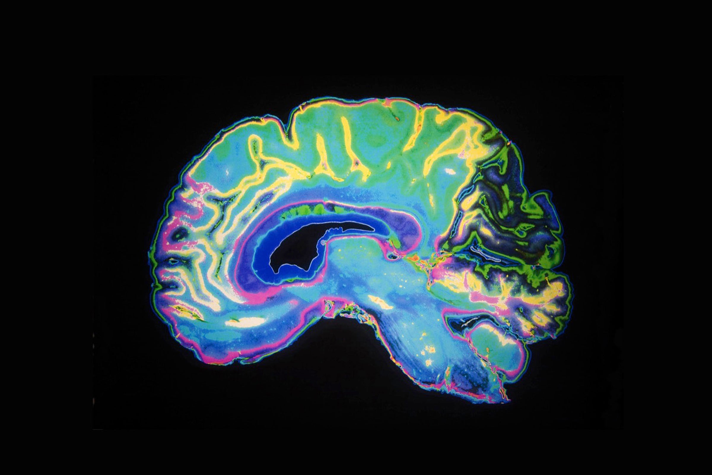 Brain slice