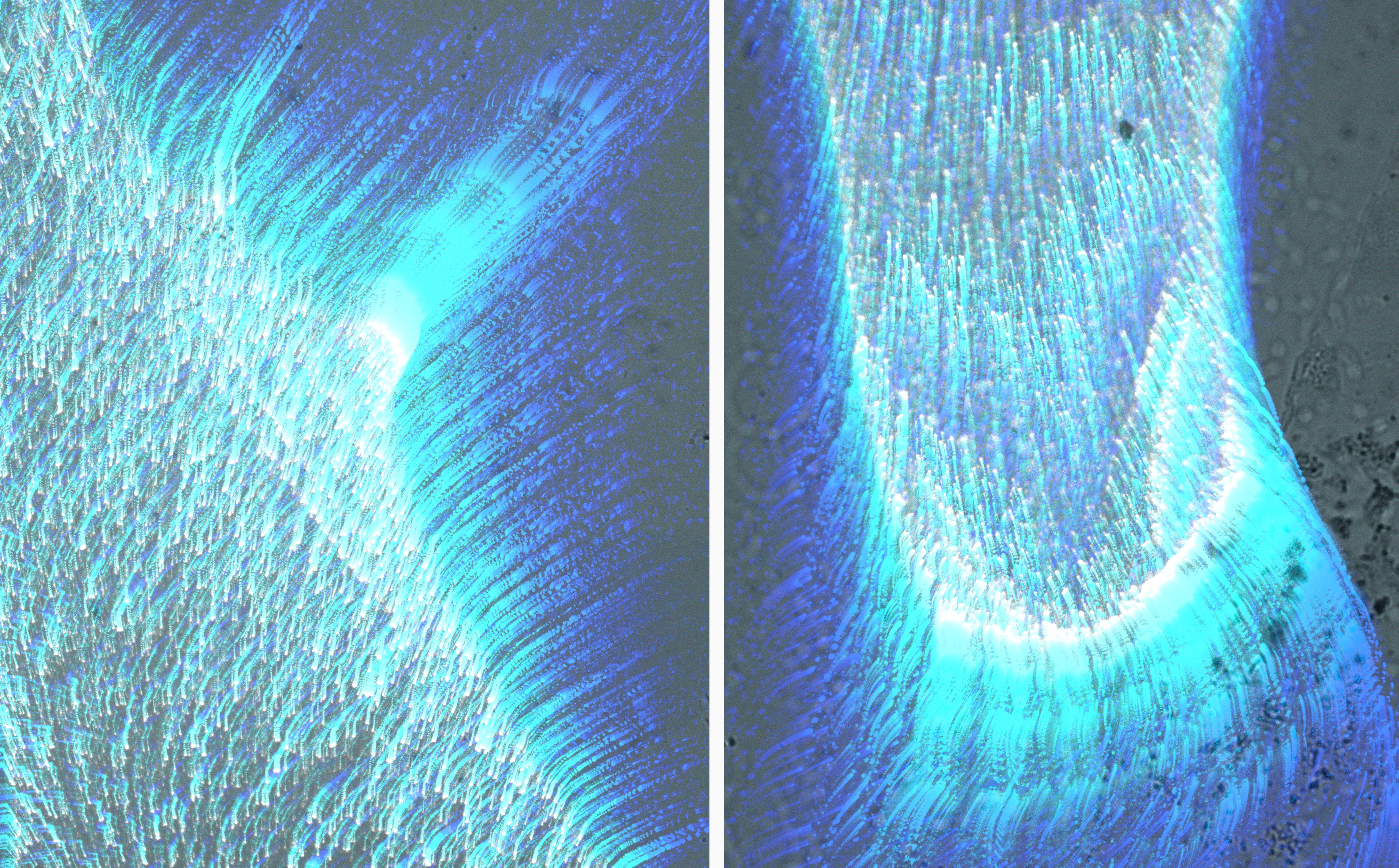 A diptych of two images, both depicting variations on a fibrous smear of blue and white short tendrils that end in an elongated darker blue set of feathery trails that resemble eyelashes.