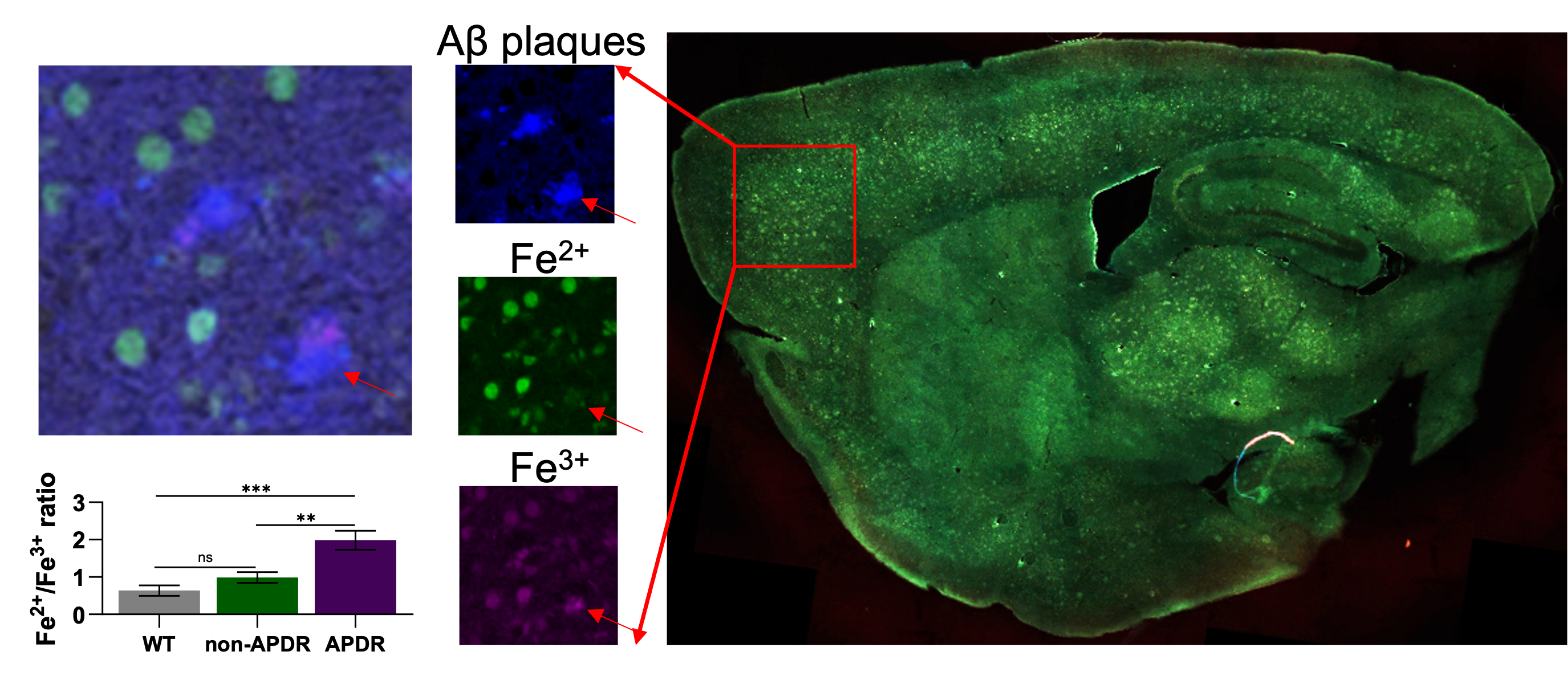 Series of images showing how different forms of iron are collocated with amyloid beta plaques in a slice of mouse brain