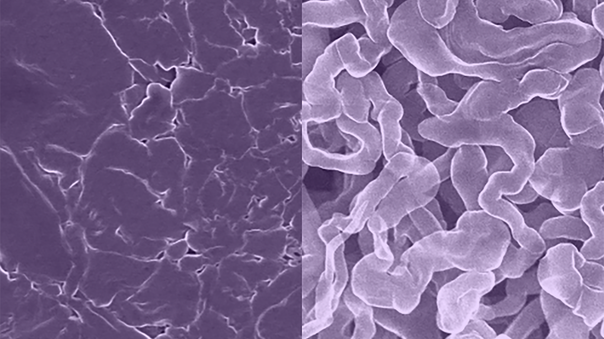 Two microscope images, side by side. On the left are thin, squiggly lines. On the right, there are structures that look like puffy worms.