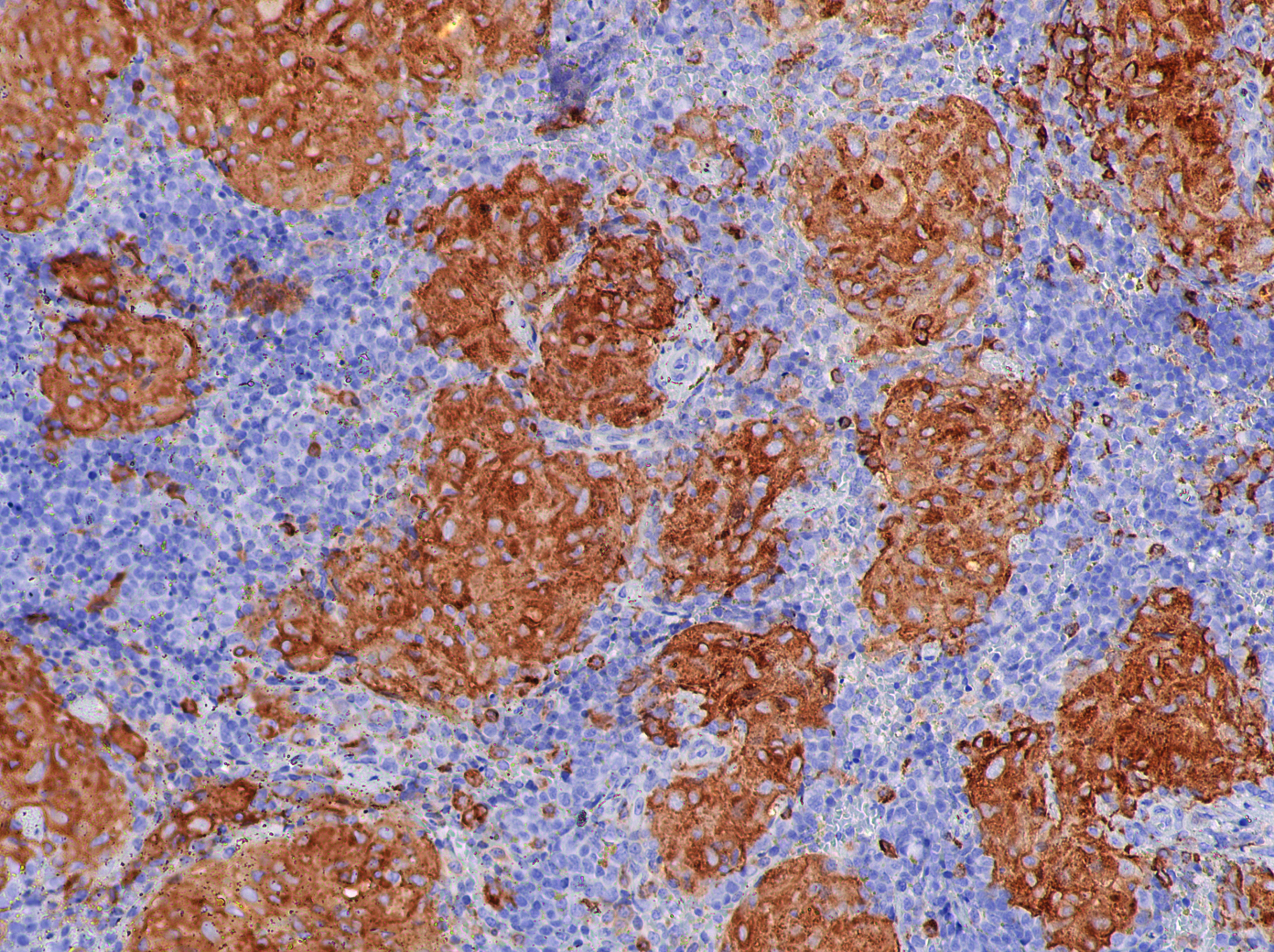 Brownish-orange islands of cells populate a blue and purple sea of other cells.