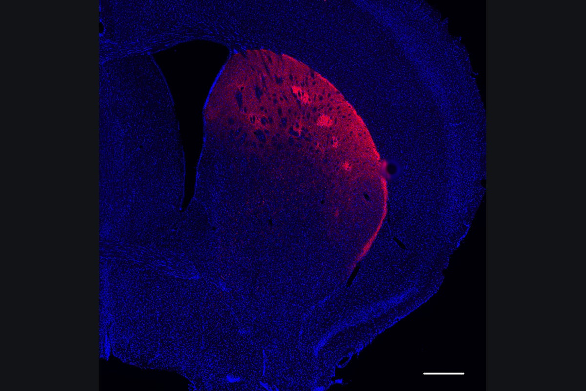 Dopamine Controls Movement, Not Just Rewards