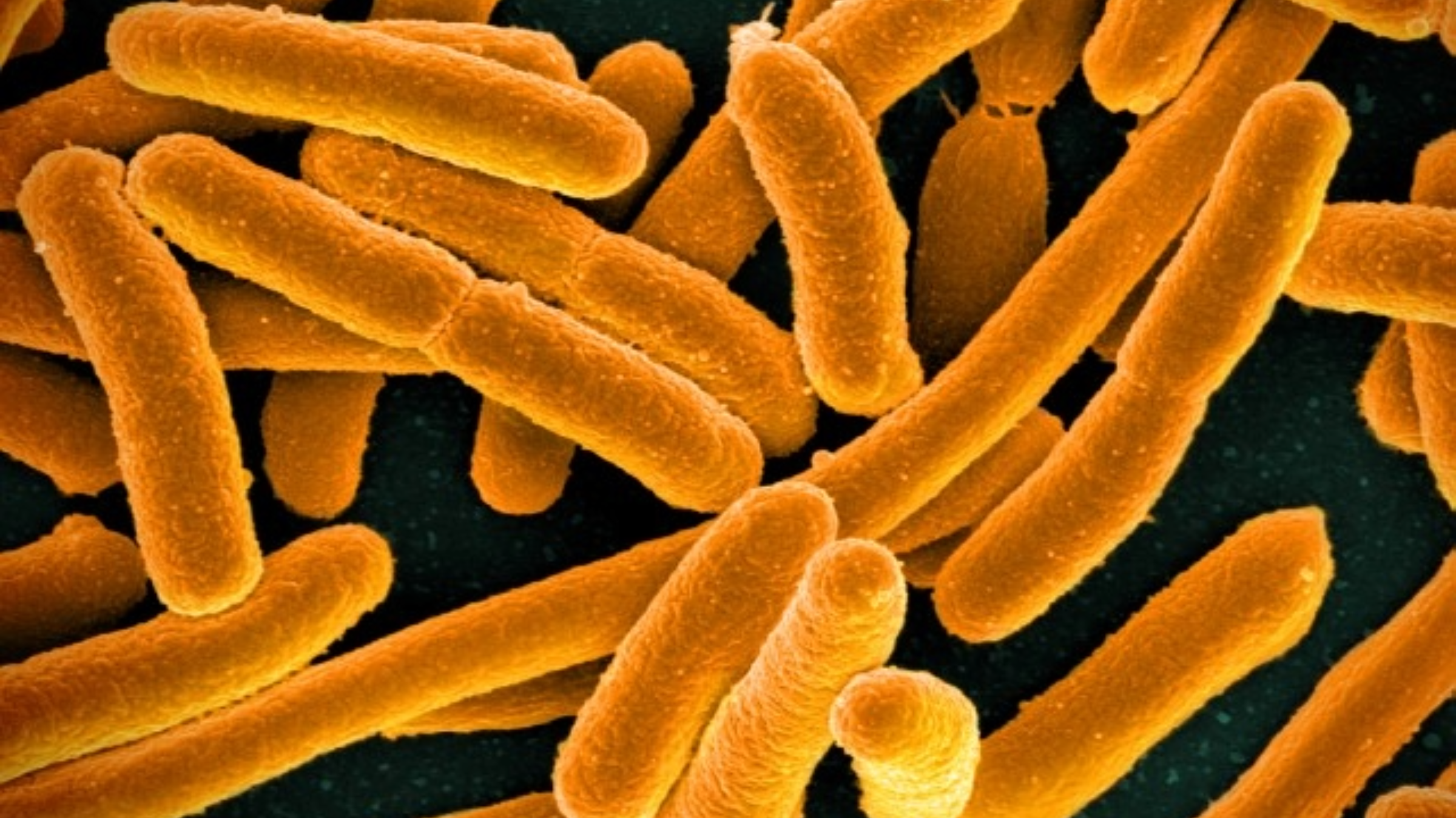 E.coli bacteria microscopic image