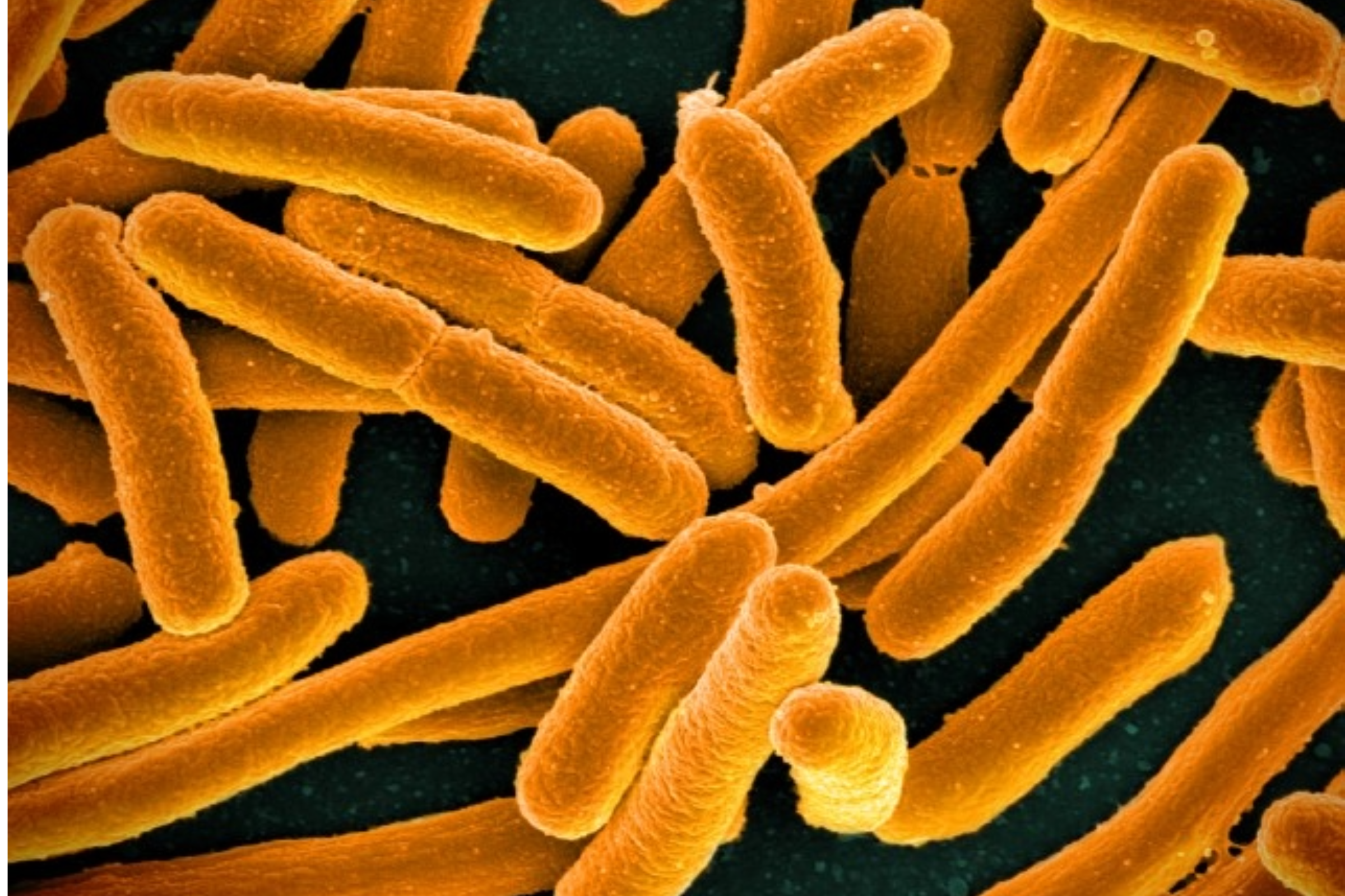 Microscopic image of E.coli bacteria