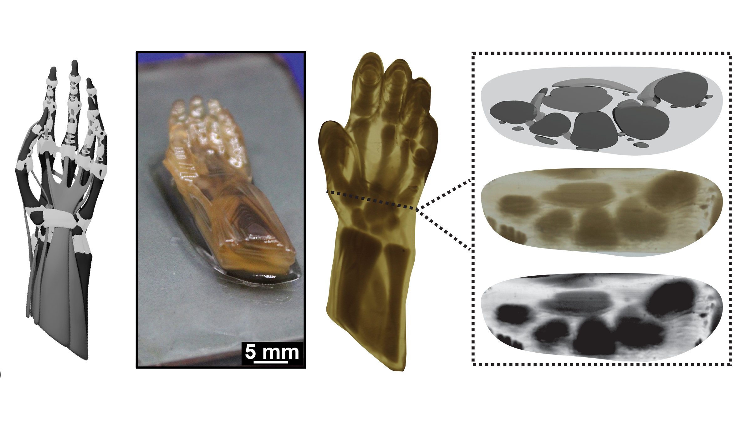Four panels show a 3D printed model of a human hand. One panel shows a grayscale image used for the printing, two show the printed hand and the final panel shows cross sections of the wrist, highlighting hard and soft regions.