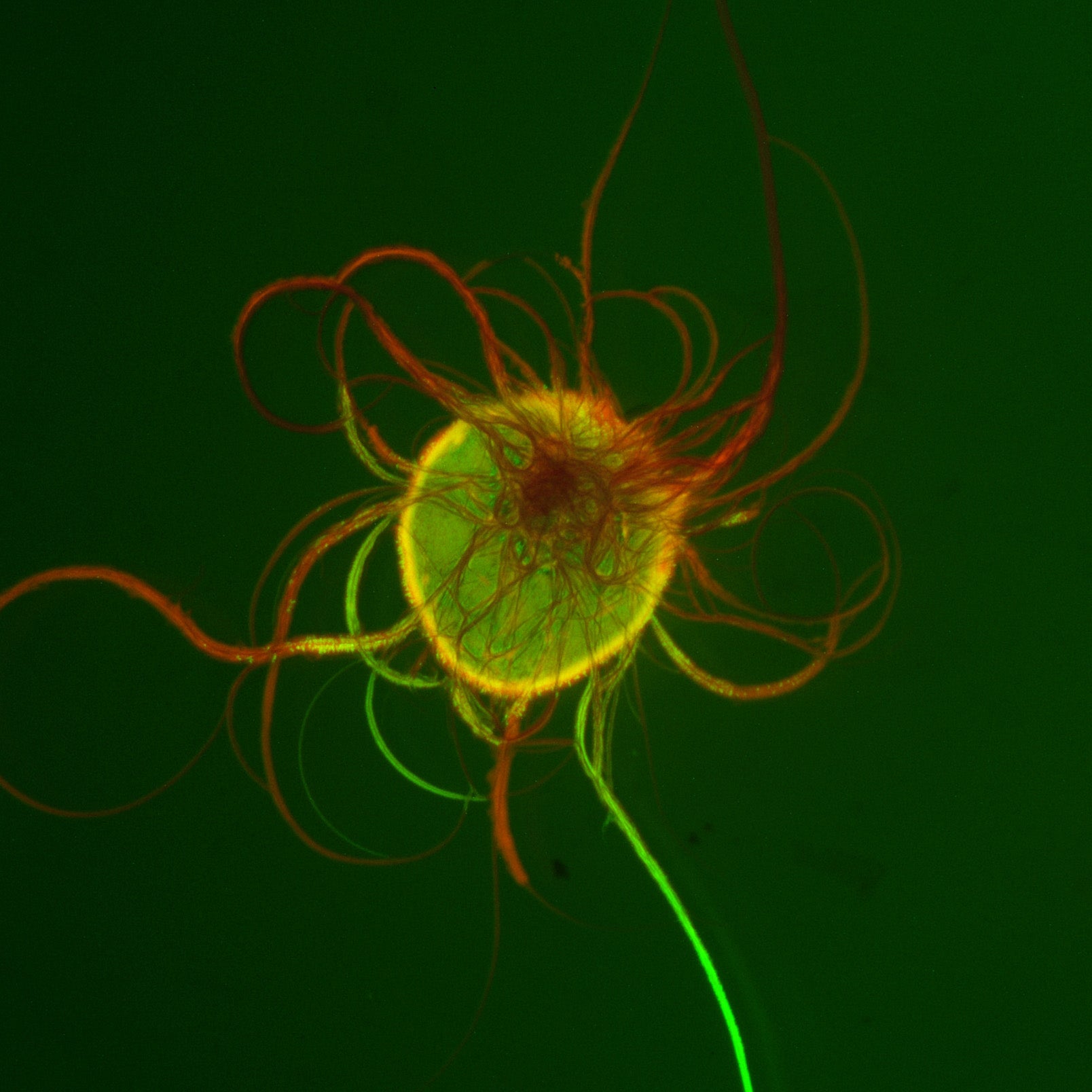 A light green sphere surrounded by a yellow border has red tendrils groding out from the forward surface and extending beyond the border into the dark green background.