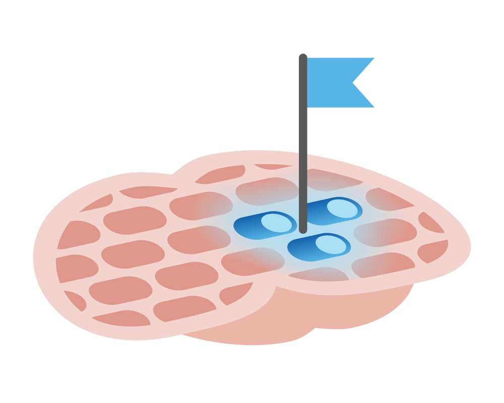 A cross-section of a brain has several switches turned on and a blue flag