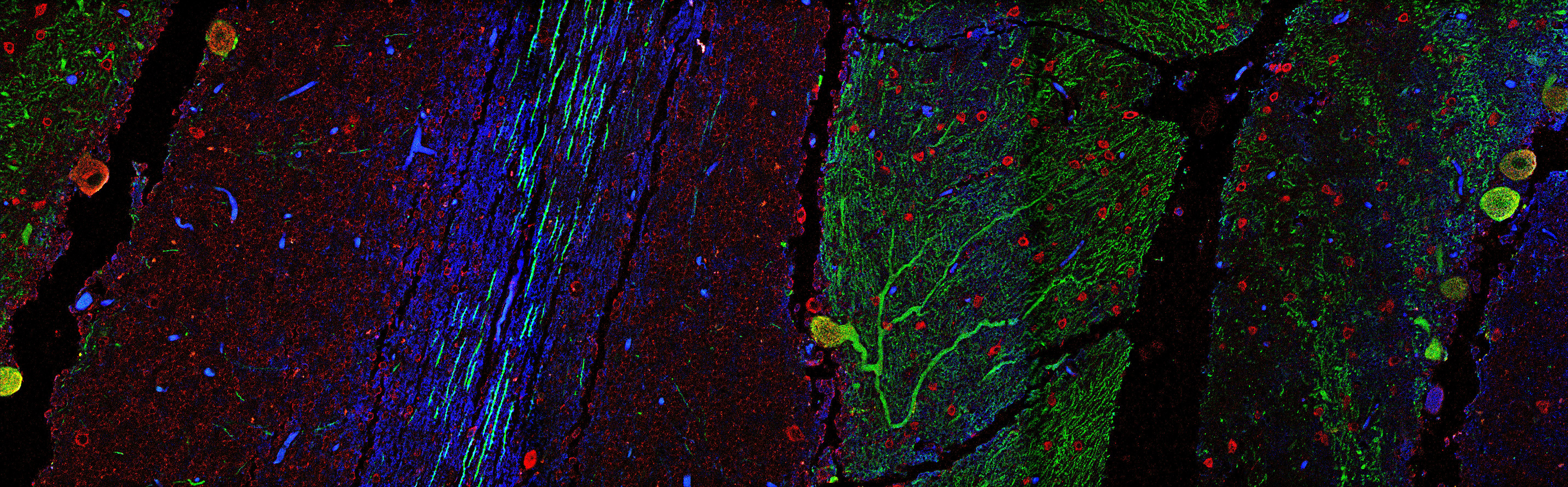 First place image of a tissue slice from a cerebellum.