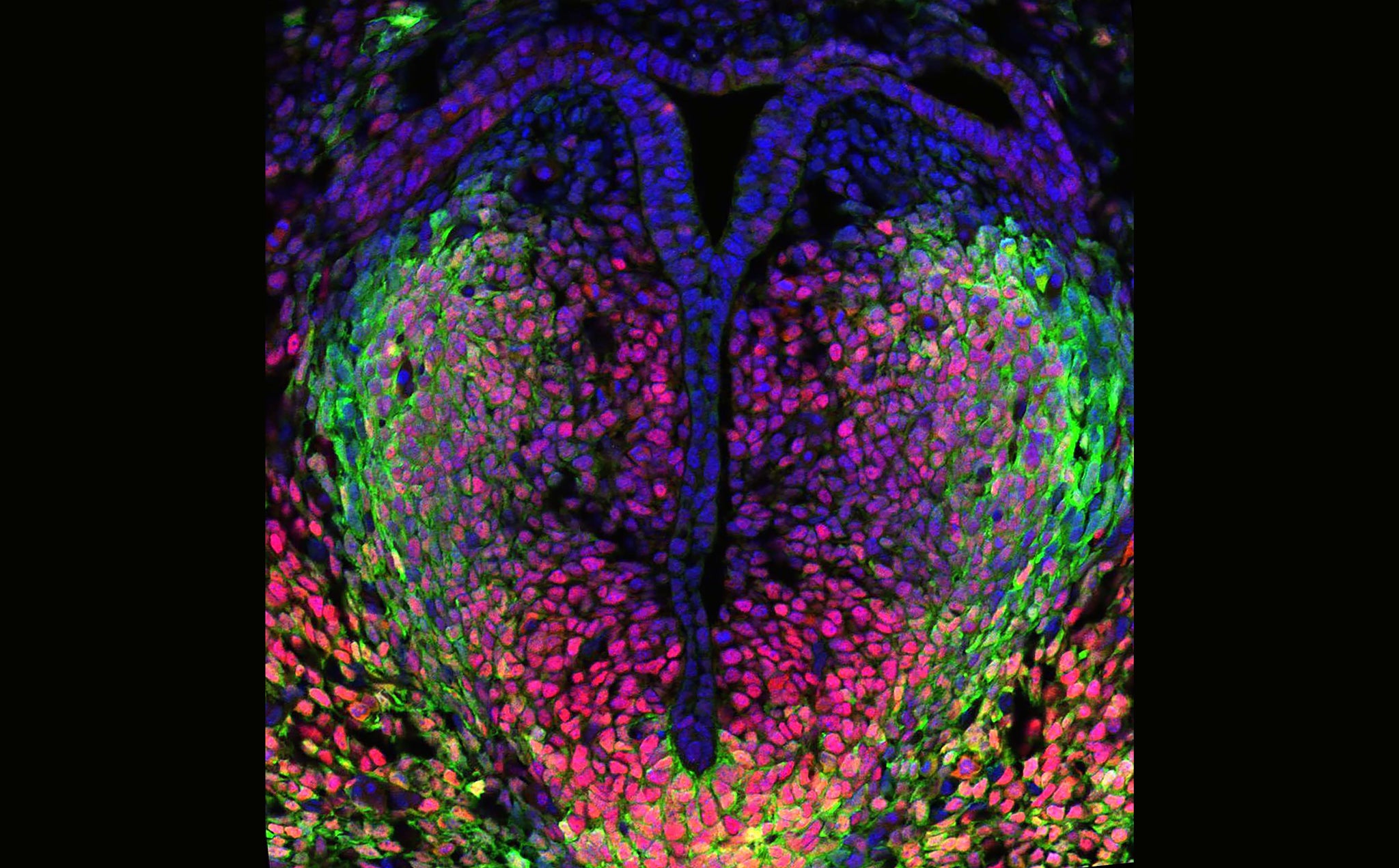 Vocal folds of a developing mouse embryo