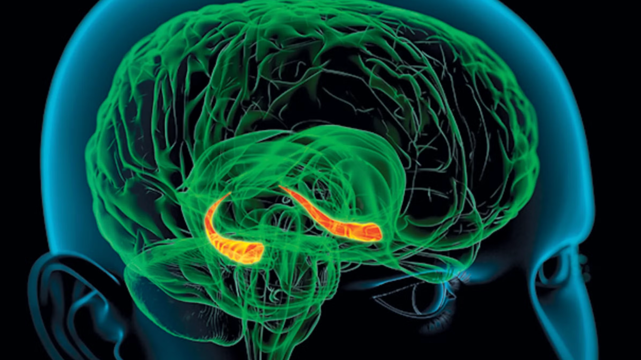 Lewy Body Dementia: Challenges for Individuals, Families, and the Health Care System