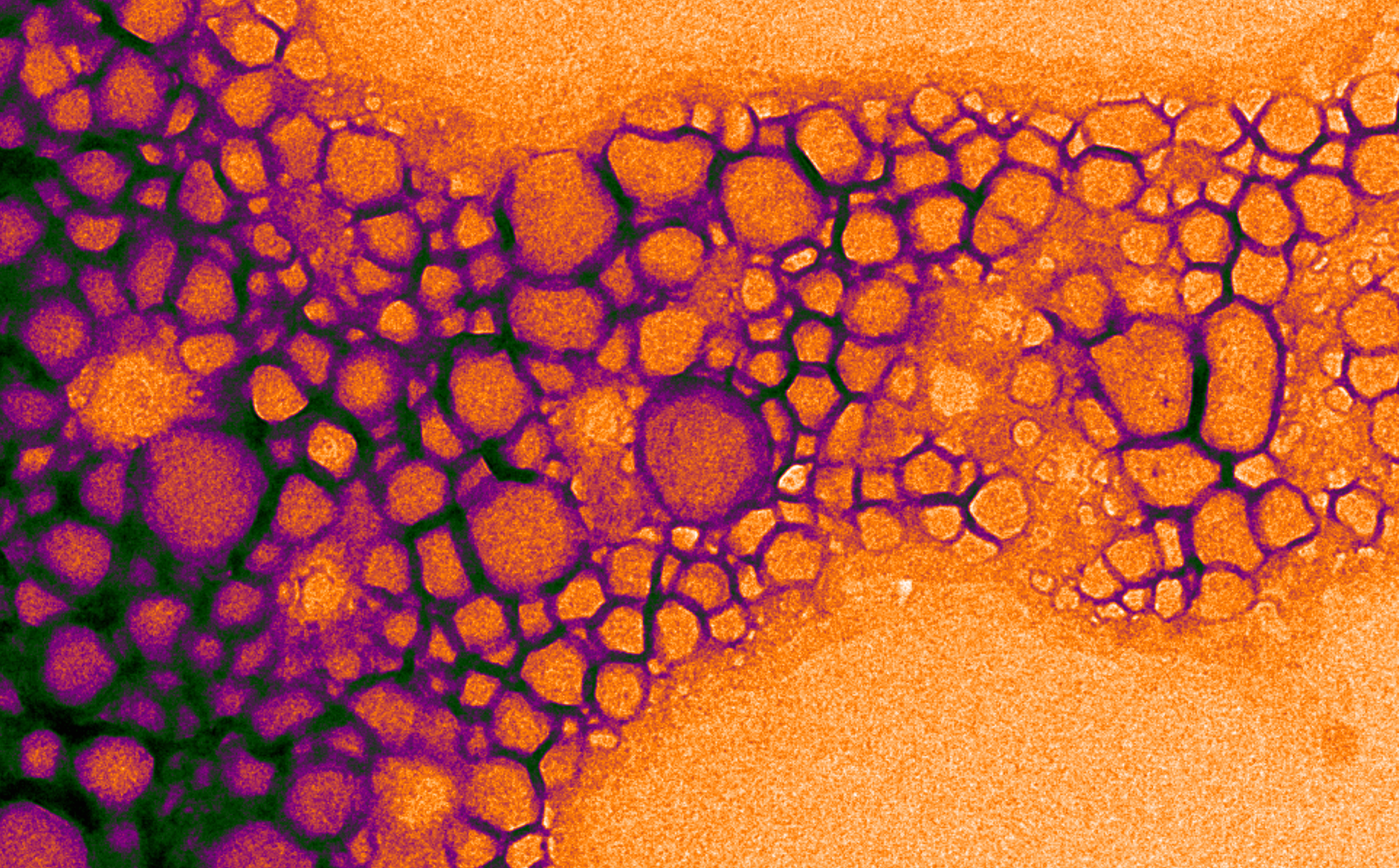 A pseudocolored transmission electron micrograph of nanodroplets filled with paramagnetic metals and perfluorocarbon materials.