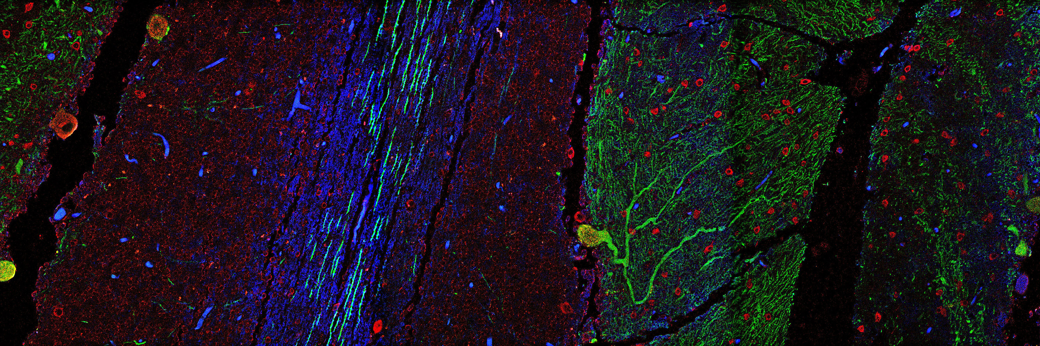 Each layer of the cerebellum can be seen in this tissue slice from a study of patients with Ataxia-Telangiectasia (A-T), an early childhood onset neurodegenerative disorder specific to the cerebellum. 